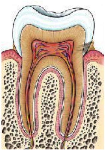 caries dentaires 1